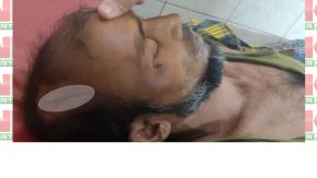 চাটখিলে ভাতিজার লাঠির আঘাতে মৃত্যু হলো চাচার